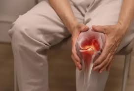 আর্থ্রাইটিস