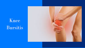 বার্সাইটিস